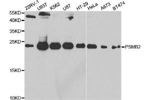 Western blot analysis of extracts of various cell lines, using PSMB2 antibody (ABIN5973193) at 1/1000 dilution.