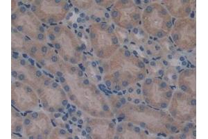 Detection of SERPINA10 in Mouse Kidney Tissue using Polyclonal Antibody to Serpin A10 (SERPINA10)