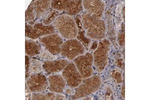 Immunohistochemical staining of human kidney with SERPINA7 polyclonal antibody  shows cytoplasmic and extracellular positivity in cells of tubules. (SERPINA7 anticorps)
