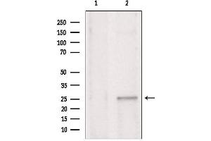 Western blot analysis of extracts from rat brain, using CHCHD6 antibody.