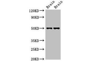 Western Blot Positive WB detected in: Mouse brain tissue, Rat brain tissue All lanes: Gfap antibody at 2. (GFAP anticorps  (AA 1-430))