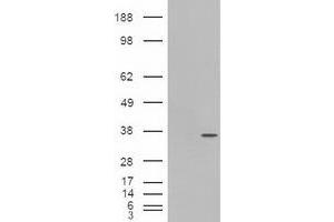 Image no. 6 for anti-Pancreatic and Duodenal Homeobox 1 (PDX1) antibody (ABIN1500144) (PDX1 anticorps)