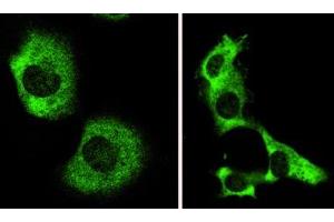 Image no. 2 for anti-Autophagy/beclin-1 Regulator 1 (AMBRA1) (N-Term) antibody (ABIN347117)