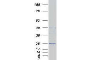 Validation with Western Blot