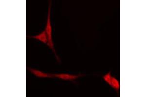 ABIN6274553 staining Hela cells by IF/ICC.