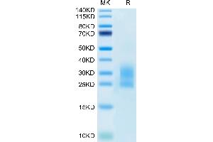 Mouse NKG2D/CD314 on Tris-Bis PAGE under reduced condition.