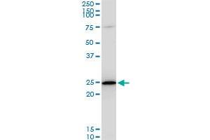 TPT1 monoclonal antibody (M06), clone 2A3.