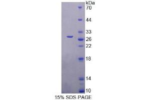 SDS-PAGE analysis of Mouse FBLN7 Protein. (FBLN7 Protéine)