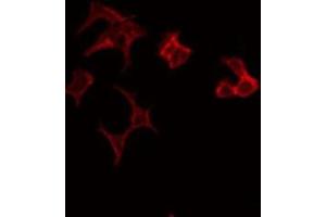 ABIN6275624 staining HeLa by IF/ICC. (CCT7 anticorps  (Internal Region))