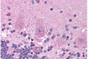 Human Brain, Cerebellum (formalin-fixed, paraffin-embedded) stained with KCNAB2 antibody ABIN214780 at 5 ug/ml followed by biotinylated goat anti-rabbit IgG secondary antibody ABIN481713, alkaline phosphatase-streptavidin and chromogen. (KCNAB2 anticorps  (AA 121-170))