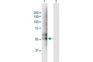Lane 1: TMPRSS2 transfected lysate ( 53.