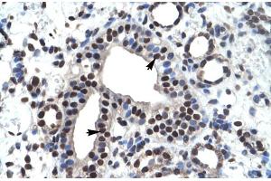 Rabbit Anti-ZNF499 Antibody Catalog Number: ARP30017 Paraffin Embedded Tissue: Human Kidney Cellular Data: Epithelial cells of collecting tubule Antibody Concentration: 4. (ZBTB45 anticorps  (Middle Region))