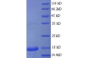 SDS-PAGE (SDS) image for Regenerating Islet Derived Protein 3 gamma (REG3g) (AA 27-174) protein (His tag) (ABIN5713786)