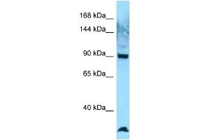Western Blotting (WB) image for anti-EZR-ROS1 (C-Term) antibody (ABIN2789629) (EZR-ROS1 (C-Term) anticorps)