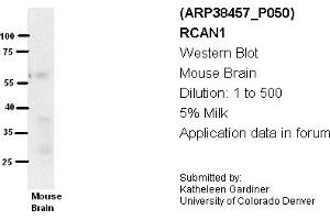 Image no. 2 for anti-Regulator of Calcineurin 1 (RCAN1) (Middle Region) antibody (ABIN405160) (RCAN1 anticorps  (Middle Region))