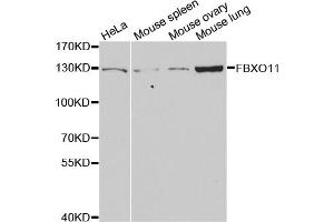 Western blot analysis of extracts of various cell lines, using FBXO11 antibody (ABIN5973628) at 1/1000 dilution.