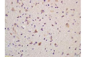 Formalin-fixed and paraffin embedded mouse brain labeled with Anti-GLUR2 Polyclonal Antibody, Unconjugated (ABIN734588) at 1:200, followed by conjugation to the secondary antibody and DAB staining (GRIA2 anticorps  (AA 151-250))