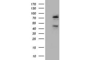 Western Blotting (WB) image for anti-NIMA (Never In Mitosis Gene A)-Related Kinase 11 (NEK11) antibody (ABIN1499683) (NEK11 anticorps)