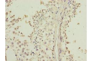 Immunohistochemistry of paraffin-embedded human testis tissue using ABIN7158154 at dilution of 1:100