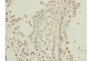 Immunohistochemistry of paraffin-embedded human testis tissue using ABIN7158154 at dilution of 1:100 (LRRC2 anticorps  (AA 1-184))