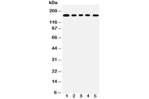 Western blot testing of MUC1 antibody and Lane 1:  COLO320