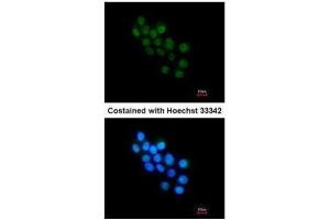 ICC/IF Image Immunofluorescence analysis of paraformaldehyde-fixed HepG2, using FOXB1, antibody at 1:200 dilution. (FOXB1 anticorps  (C-Term))