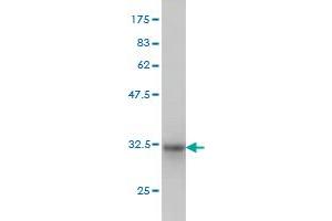 Western Blot detection against Immunogen (31.