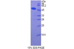 SDS-PAGE (SDS) image for Collagen, Type XIV, alpha 1 (COL14A1) (AA 1280-1461) protein (His tag,GST tag) (ABIN1877633)