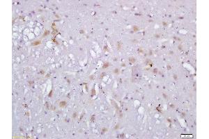Formalin-fixed and paraffin embedded rat brain labeled with Anti-RLBP1L1 Polyclonal Antibody, Unconjugated  followed by conjugation to the secondary antibody and DAB staining