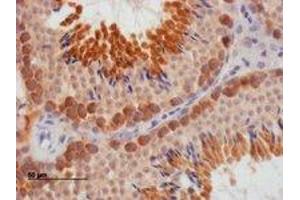 Immunohistochemistry (IHC) image for anti-Deleted in Azoospermia-Like (DAZL) (Internal Region) antibody (ABIN2465585) (DAZL anticorps  (Internal Region))