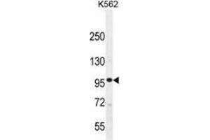 Western blot analysis in K562 cell line lysates (35ug/lane) using MLCK Antibody . (MYLK anticorps  (Middle Region))