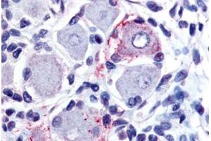 Human Spinal Cord, Dorsal Root Ganglion (formalin-fixed, paraffin-embedded) stained with GPR149 antibody ABIN213495 at 20 ug/ml followed by biotinylated goat anti-rabbit IgG secondary antibody ABIN481713, alkaline phosphatase-streptavidin and chromogen.