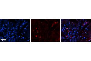 Rabbit Anti-SELENBP1 Antibody     Formalin Fixed Paraffin Embedded Tissue: Human Lung Tissue  Observed Staining: Cytoplasmic, membrane and nuclear in alveolar type I & II cells  Primary Antibody Concentration: 1:100  Other Working Concentrations: 1/600  Secondary Antibody: Donkey anti-Rabbit-Cy3  Secondary Antibody Concentration: 1:200  Magnification: 20X  Exposure Time: 0.