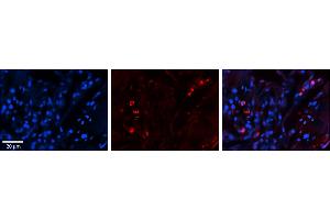 Rabbit Anti-SELENBP1 Antibody     Formalin Fixed Paraffin Embedded Tissue: Human Lung Tissue  Observed Staining: Cytoplasmic, membrane and nuclear in alveolar type I & II cells  Primary Antibody Concentration: 1:100  Other Working Concentrations: 1/600  Secondary Antibody: Donkey anti-Rabbit-Cy3  Secondary Antibody Concentration: 1:200  Magnification: 20X  Exposure Time: 0. (SELENBP1 anticorps  (C-Term))