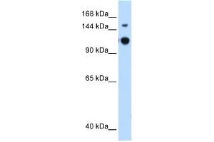 WB Suggested Anti-GAPVD1 Antibody Titration:  0. (GAPVD1 anticorps  (N-Term))