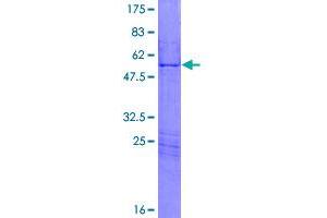 Image no. 1 for Homeobox A7 (HOXA7) (AA 1-230) protein (GST tag) (ABIN1306938)