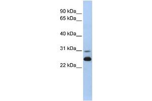 WB Suggested Anti-AK1 Antibody Titration:  0. (Adenylate Kinase 1 anticorps  (N-Term))
