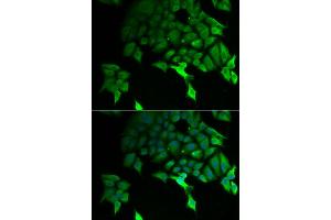 Immunofluorescence analysis of U2OS cells using TSC22D3 antibody (ABIN5974107). (TSC22D3 anticorps)