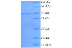 SDS-PAGE (SDS) image for Hydroxysteroid (11-Beta) Dehydrogenase 1 (HSD11B1) (AA 25-292) protein (His-SUMO Tag) (ABIN5709687)