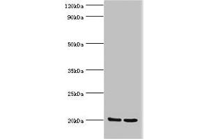Western blot All lanes: GLO1 antibody at 2 μg/mL Lane 1: HepG2 whole cell lysate Lane 2: Hela whole cell lysate Secondary Goat polyclonal to rabbit IgG at 1/10000 dilution Predicted band size: 21, 20 kDa Observed band size: 21 kDa (GLO1 anticorps  (AA 1-184))