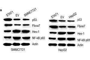 Effect of STAT1 on p53, Fbxw7, Hes-1 and NF-κB p65. (p53 anticorps  (AA 301-393))