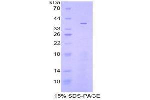 SDS-PAGE analysis of Rat Apolipoprotein C1 Protein. (APOC1 Protéine)