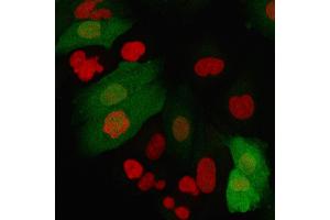 Immunofluorescence staining of A549 cells using S100A4 Recombinant Mouse Monoclonal Antibody (rS100A4/1481) followed by goat anti-Mouse IgG conjugated to CF488 (green).