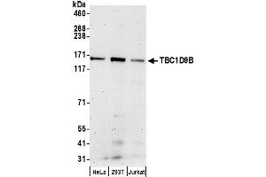anti-TBC1 Domain Family, Member 9B (With GRAM Domain) (TBC1D9B) (AA 1200-1250) antibody