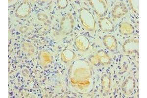 Immunohistochemistry of paraffin-embedded human kidney tissue using ABIN7156743 at dilution of 1:100 (IL1R1 anticorps  (AA 18-320))