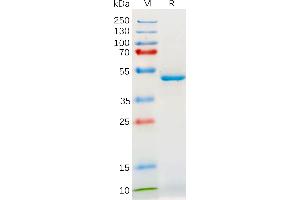 Interleukin 18 (IL18) (AA 37-197) protein (mFc Tag)