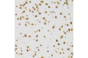 Immunohistochemistry of paraffin-embedded mouse brain using CSRP3 Antibody (ABIN2562048) at dilution of 1:100 (40x lens). (CSRP3 anticorps)