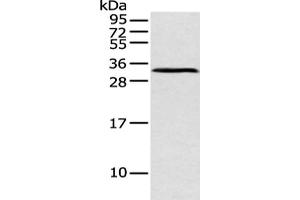 Gel: 12 % SDS-PAGE, Lysate: 40 μg, Lane: Mouse pancreas tissue, Primary antibody: ABIN7128589(ATP4B Antibody) at dilution 1/250 dilution, Secondary antibody: Goat anti rabbit IgG at 1/8000 dilution, Exposure time: 1 minute (ATP4b anticorps)