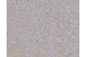 IHC analysis of WDR7 using anti-WDR7 antibody (ABIN7600939). (WDR7 anticorps  (AA 258-1292))