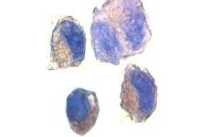 Immunocytochemical staining of K562 cells with ADAM10 antibody at 2ug/ml. (ADAM10 anticorps)
